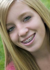 teen wearing braces